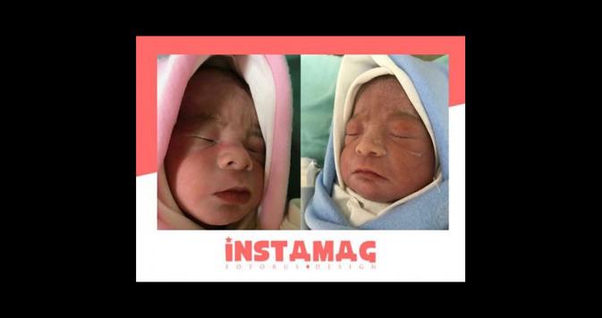 314th & 315th Twin baby boy born on 7.6.2017